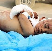 صورة الطوائف المسيحية بسوريا تشعر بخطر الانقراض بسبب التدخل التركي وداعش