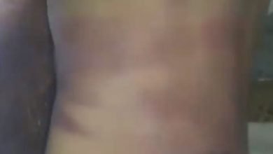 صورة قتل طفله تعذيباً في درعا.. مشاهد لجثة الصغير لا يحتملها قلب