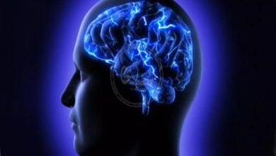 صورة العصبية.. ملّة الانتهازيين وعقيدة المتشددين